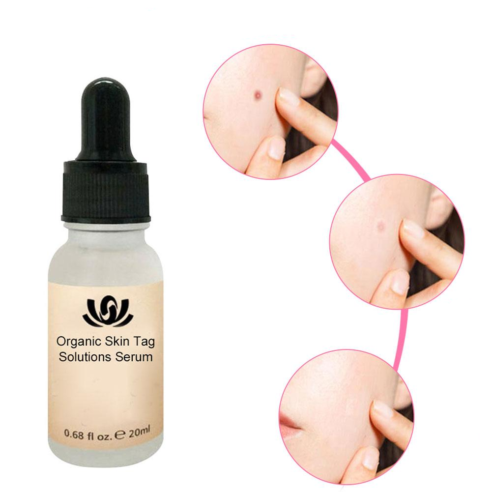 HerbCare™ Organic Skin Spot Serum | Entferne lästige Hautflecken dauerhaft!