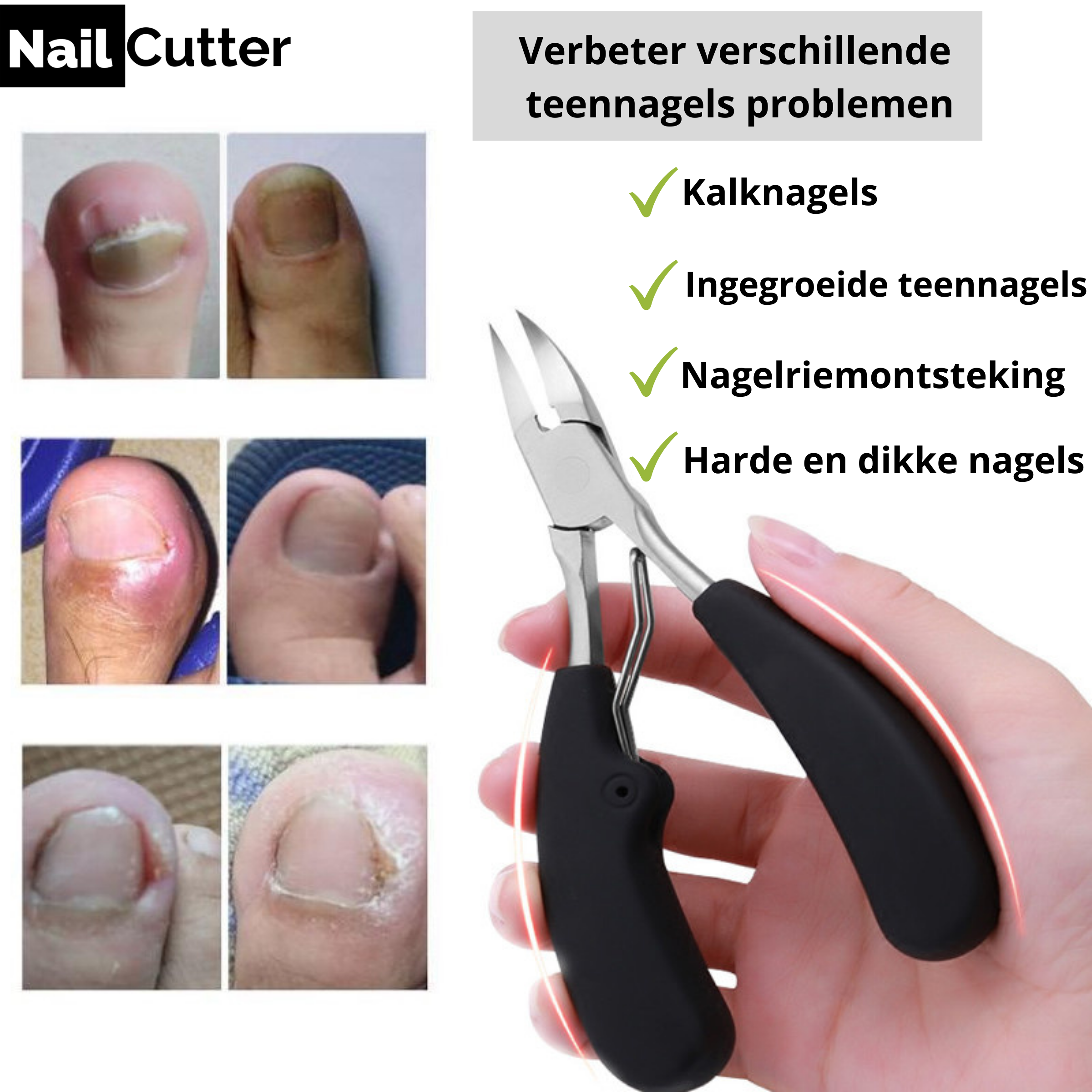NailcutterPro™ Der ultimative pflegende Nagelknipser!